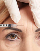 Botox BH - Botox Contra Rugas - Injecao Botox na Testa - Rejuvenescimento